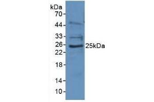 Rabbit Detection antibody from the kit in WB with Positive Control: Sample Human Jurkat Cells. (EBI3 CLIA Kit)