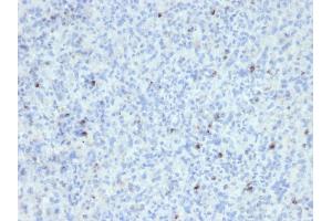 Formalin-fixed, paraffin-embedded human Spleen stained with Perforin Mouse Monoclonal Antibody (SPM434). (Perforin 1 抗体  (AA 413-552))