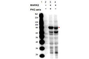Western blot using MARK2 (phospho T595) polyclonal antibody  shows detection of a band at ~82 kDa corresponding to phosphorylated MARK2 (arrowhead). (MARK2 抗体  (pThr595))