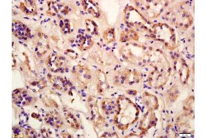 Formalin-fixed and paraffin embedded human kidney labeled with Anti-Megalin Polyclonal Antibody, Unconjugated (ABIN750988) at 1:200 followed by conjugation to the secondary antibody and DAB staining (LRP2 抗体  (AA 3401-3500))