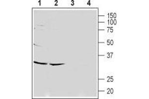 Western blot analysis of rat (lanes 1 and 3) and mouse (lanes 2 and 4) brain lysates: - 1,2. (CACNG7 抗体  (1st Extracellular Loop))