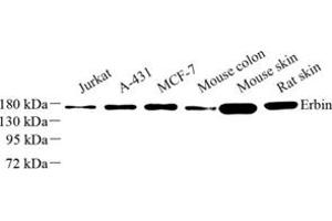 Western blot analysis of Erbin (ABIN7073858) at dilution of 1: 500 (ERBB2IP 抗体)