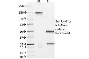SDS-PAGE Analysis Purified IgA Secretory Component Mouse Monoclonal Antibody (ECM1/792). (Recombinant ECM1 抗体)