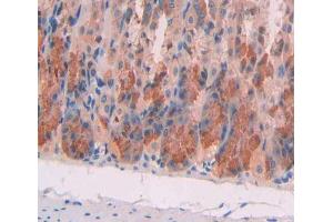 Used in DAB staining on fromalin fixed paraffin- embedded stomach tissue (MCCC1 抗体  (AA 484-717))