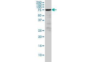 RDX monoclonal antibody (M03), clone 1F6 Western Blot analysis of RDX expression in A-431 . (Radixin 抗体  (AA 1-583))
