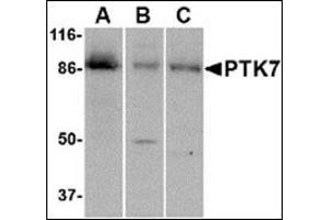 Western blot analysis of PTK7 in (A) human colon, (B) mouse kidney and (C) rat liver tissue lysate with this product at 1 μg/ml. (PTK7 抗体  (C-Term))