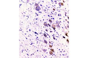 IHC analysis of CD2AP using anti-CD2AP antibody (ABIN6719544).