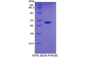 SDS-PAGE (SDS) image for Cytochrome P450, Family 1, Subfamily A, Polypeptide 1 (CYP1A1) protein (ABIN3009103)