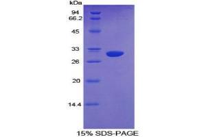 SDS-PAGE analysis of Mouse Cytochrome P450 1A1 Protein.