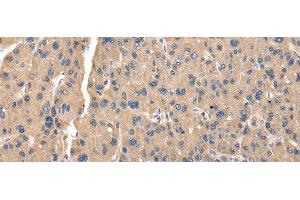 Immunohistochemistry (Paraffin-embedded Sections) (IHC (p)) image for anti-Zinc Finger, AN1-Type Domain 5 (ZFAND5) antibody (ABIN7245737)