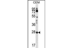 RARRES1 Antibody (C-term) (ABIN657062 and ABIN2846226) western blot analysis in CEM cell line lysates (35 μg/lane). (RARRES1 抗体  (C-Term))
