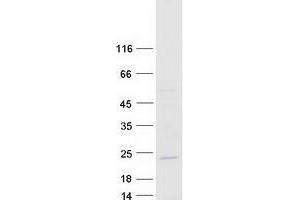 Western Blotting (WB) image for Growth Arrest and DNA-Damage-Inducible, beta (GADD45B) protein (Myc-DYKDDDDK Tag) (ABIN2721555)
