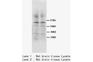 Image no. 1 for anti-Protein Kinase C, gamma (PRKCG) (C-Term) antibody (ABIN1493310) (PKC gamma 抗体  (C-Term))