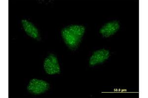 Immunofluorescence of purified MaxPab antibody to R3HDM2 on HeLa cell. (R3HDM2 抗体  (AA 1-637))