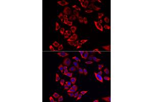 Immunofluorescence analysis of MCF-7 cells using RPL9 antibody (ABIN6291201). (RPL9 抗体)