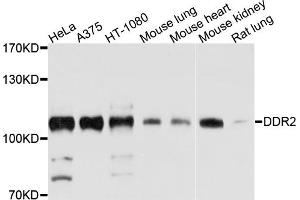 Western blot analysis of extracts of various cell lines, using DDR2 antibody (ABIN4903459) at 1:1000 dilution. (DDR2 抗体)