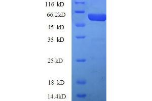 SDS-PAGE (SDS) image for Pregnancy Zone Protein (PZP) (AA 472-821) protein (His tag) (ABIN5710197)