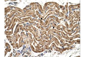 Immunohistochemistry (IHC) image for anti-ATP Synthase, H+ Transporting, Mitochondrial F1 Complex, beta Polypeptide (ATP5B) (N-Term) antibody (ABIN2783268) (ATP5B 抗体  (N-Term))