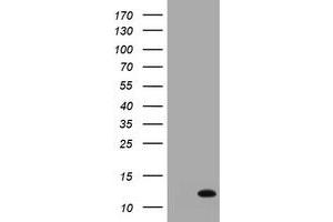 Image no. 1 for anti-S100 Calcium Binding Protein A6 (S100A6) antibody (ABIN1500784) (S100A6 抗体)