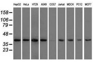 Image no. 2 for anti-3-hydroxyisobutyryl-CoA Hydrolase (HIBCH) antibody (ABIN1498653) (HIBCH 抗体)