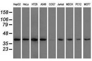 Image no. 2 for anti-3-hydroxyisobutyryl-CoA Hydrolase (HIBCH) antibody (ABIN1498653)