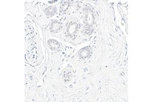 Immunohistochemistry (IHC) image for anti-Glyceraldehyde-3-Phosphate Dehydrogenase (GAPDH) (AA 250-300) antibody (ABIN7453833)