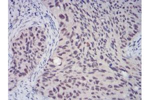 Immunohistochemistry (IHC) image for anti-Chromobox Homolog 4 (CBX4) (AA 397-514) antibody (ABIN5542423)