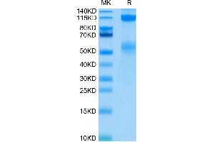 SDS-PAGE (SDS) image for Insulin-Like Growth Factor 1 Receptor (IGF1R) (AA 31-932) protein (His-Avi Tag) (ABIN7274862)