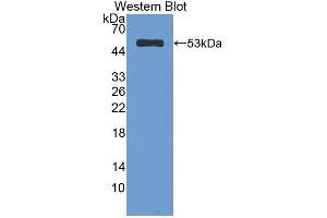 Western blot analysis of the recombinant protein. (CELA1 抗体  (AA 40-258))