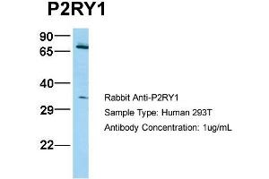 Host: Rabbit   Target Name: P2RY1   Sample Tissue: 293T  Antibody Dilution: 1. (P2RY1 抗体  (N-Term))