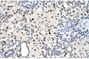 Rabbit Anti-PSME3 Antibody  Paraffin Embedded Tissue: Human Kidney Cellular Data: Epithelial cells of renal tubule Antibody Concentration: 4. (PSME3 抗体  (N-Term))