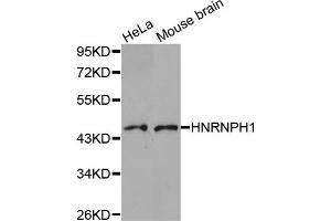 Western blot analysis of extracts of various cell lines, using HNRNPH1 antibody (ABIN5973515). (HNRNPH1 抗体)