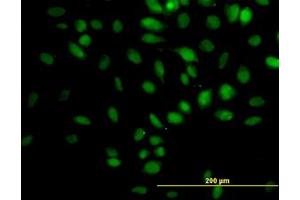 Image no. 5 for anti-Tripartite Motif Containing 33 (TRIM33) (AA 1006-1106) antibody (ABIN599250) (TRIM33 抗体  (AA 1006-1106))