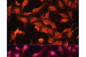 Immunofluorescence analysis of C6 cells using ABCB10 Polyclonal Antibody at dilution of 1:100. (ABCB10 抗体)