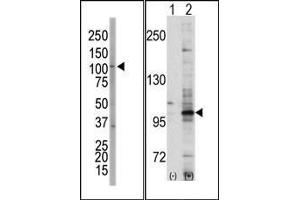 (LEFT)Western blot analysis of anti-EphA7 Pab in NCI-H460 cell lysate. (EPH Receptor A7 抗体  (C-Term))