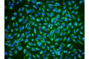IF analysis of ALDH2 using anti-ALDH2 antibody (ABIN7603122). (ALDH2 抗体  (N-Term))