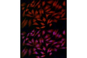 Immunohistochemistry (IHC) image for anti-Ferritin, Heavy Polypeptide 1 (FTH1) (AA 1-183) antibody (ABIN3021539)
