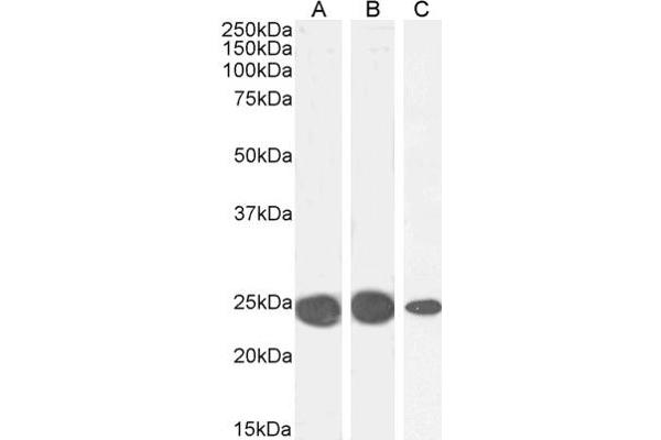 CBX5 抗体  (Internal Region)