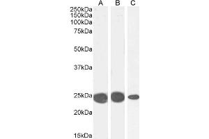 ABIN185491 (0. (CBX5 抗体  (Internal Region))