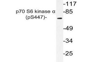 Western blot (WB) analyzes of p-p70 S6 kinase alpha antibody in extracts from A549 PMA cells. (RPS6KB1 抗体  (pSer447))