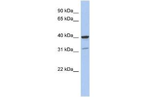 WB Suggested Anti-THPO Antibody Titration: 0. (Thrombopoietin 抗体  (Middle Region))