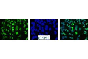 Image no. 5 for anti-DNA Repair Protein Apurinic Endonuclease antibody (ABIN5693483) (DNA Repair Protein Apurinic Endonuclease 抗体)