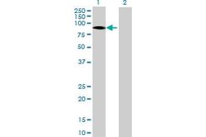 Western Blotting (WB) image for ITPKB 293T Cell Transient Overexpression Lysate(Denatured) (ABIN1332409)