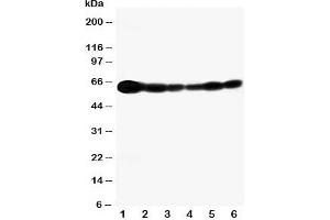 Western blot testing of SHC antibody and Lane 1:  rat brain; and human samples  2: A549;  3: A431;  4: 293T;  5: HeLa;  6: Jurkat cell lysate.