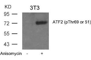 Western blot analysis of extracts from 3T3 cells untreated or treated with Anisomycin using ATF2(Phospho-Thr69 or 51) Antibody.