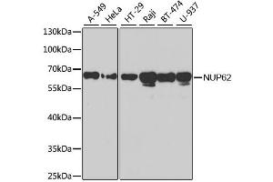 Western blot analysis of extracts of various cell lines, using NUP62 antibody. (NUP62 抗体)