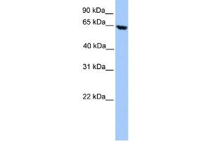 WB Suggested Anti-ACADVL Antibody Titration: 0. (ACADVL 抗体  (N-Term))
