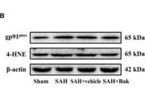 The effect of Bak on the oxidative stress 24 h after SAH. (beta Actin 抗体  (AA 1-375))