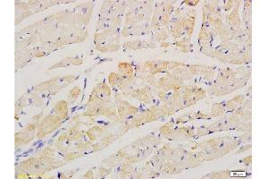 Formalin-fixed and paraffin embedded rat heart labeled with Anti-factor V Polyclonal Antibody, Unconjugated  at 1:200 followed by conjugation to the secondary antibody and DAB staining. (Factor 5 (AA 301-400) 抗体)