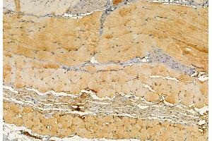ABIN6266079 and ABIN6272868 at 1/100 staining Mouse skin tissue by IHC-P.